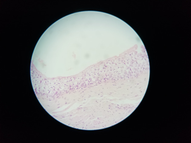 Transitional Epithelium Slides - Transitional Epithelium 03 400X